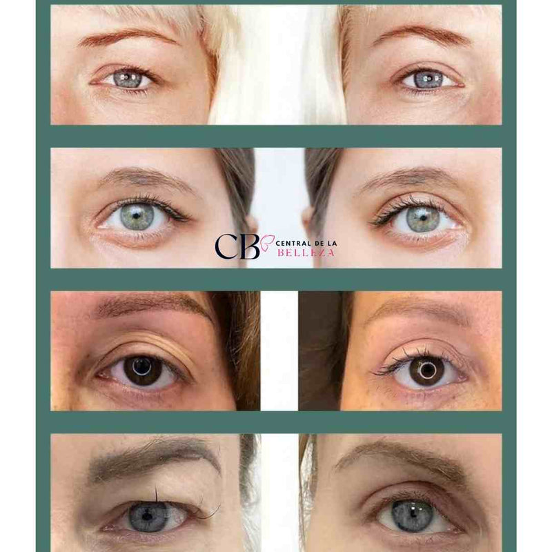 VivaMirada: Cintas Lifting para Párpados, Mirada Más Juvenil y Radiante - 240uds
